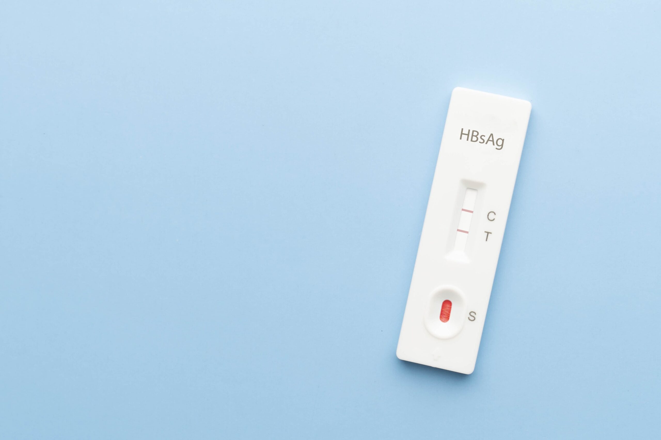 Hepatitis B Virus Surface Antigen Test Kit with positive result on blue background
